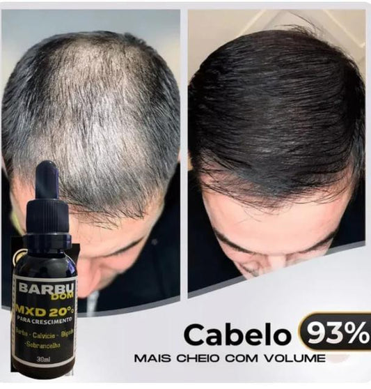 Sérum Capilar MXD20 PAGUE NA ENTREGA (Receba em menos de 24h) ☑️