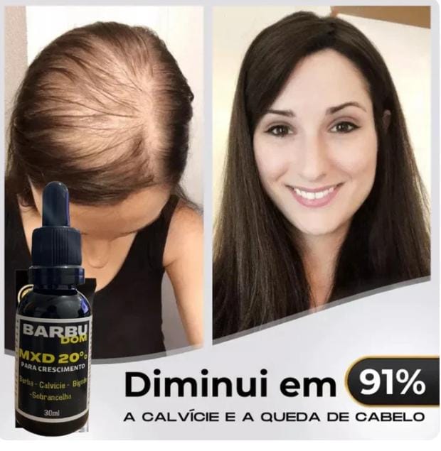 Sérum Capilar MXD20 PAGUE NA ENTREGA (Receba em menos de 24h) ☑️