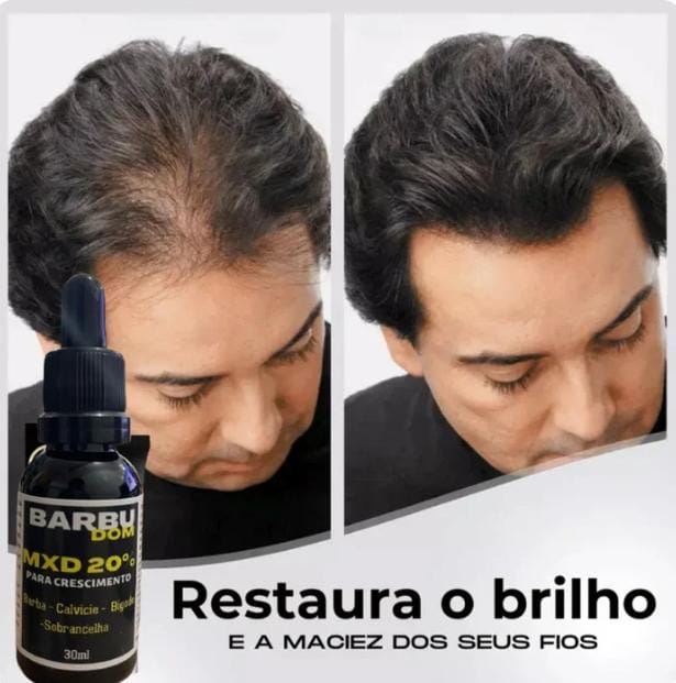 Sérum Capilar MXD20 PAGUE NA ENTREGA (Receba em menos de 24h) ☑️