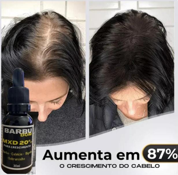 Sérum Capilar MXD20 PAGUE NA ENTREGA (Receba em menos de 24h) ☑️